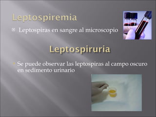 Leptospiras en sangre al microscopio Se puede observar las leptospiras al campo oscuro en sedimento urinario 