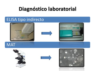 Diagnóstico laboratorial
ELISA tipo indirecto
MAT
 