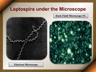 Leptospira under the Microscope
Electron Microscope
Dark Field Microscopy FL
 