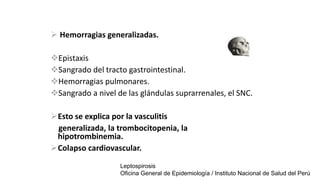  Hemorragias generalizadas.
Epistaxis
Sangrado del tracto gastrointestinal.
Hemorragias pulmonares.
Sangrado a nivel de las glándulas suprarrenales, el SNC.
Esto se explica por la vasculitis
generalizada, la trombocitopenia, la
hipotrombinemia.
Colapso cardiovascular.
Leptospirosis
Oficina General de Epidemiología / Instituto Nacional de Salud del Perú
 