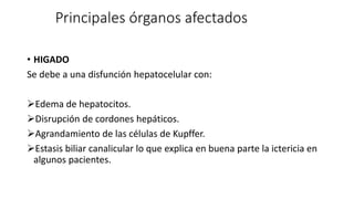 Principales órganos afectados
• HIGADO
Se debe a una disfunción hepatocelular con:
Edema de hepatocitos.
Disrupción de cordones hepáticos.
Agrandamiento de las células de Kupffer.
Estasis biliar canalicular lo que explica en buena parte la ictericia en
algunos pacientes.
 