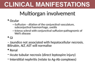 Multiorgan involvement
 Ocular
—Suffusion – dilation of the conjunctival vasculature,
subconjuctival haemorrhage, uveitis
—Icterus scleral with conjunctival suffusion-pathognomic of
Weil’s disease
 GI
– Jaundice not associated with hepatocellular necrosis.
Bilirubin, ALT, AST will normalise
 Renal
– Acute tubular necrosis (direct leptospire injury)
– Interstitial nephritis (relate to Ag-Ab complexes)
CLINICAL MANIFESTATIONS
 