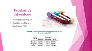 Pruebas de
laboratorio
1.
2.
3.
Hemograma completo
Pruebas serológicas
Análisis de PCR
 