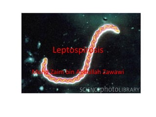 Leptospirosis
Mohd Zaim bin Abdullah Zawawi
 