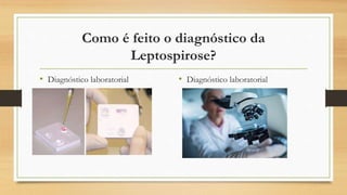 Como é feito o diagnóstico da
Leptospirose?
• Diagnóstico laboratorial • Diagnóstico laboratorial
 