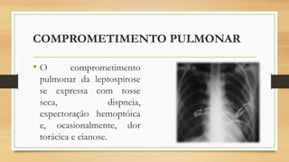 COMPROMETIMENTO PULMONAR
• O comprometimento
pulmonar da leptospirose
se expressa com tosse
seca, dispneia,
expectoração hemoptóica
e, ocasionalmente, dor
torácica e cianose.
 