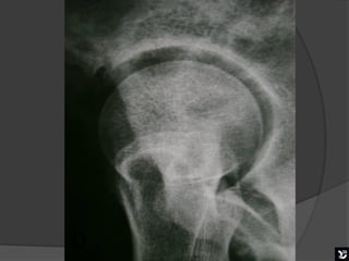 D   Boa mobilização
 