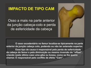 IMPACTO DE TIPO CAM

Osso a mais na parte anterior
da junção cabeça-colo e perda
  de esfericidade da cabeça


         O osso excedentário no femur localiza-se tipicamente na parte
anterior da junção cabeça colo, podendo ou não ter extensão superior.
         Esse tipo de causa é responsável pela perda de esfericidade
da cabeça do femur e pela diminuição ou mesmo inversão do “offset”,
criando neste último caso uma giba ou bossa, como se lhe queira
chamar. É responsável pelo conflito de efeito “Cam”.
 