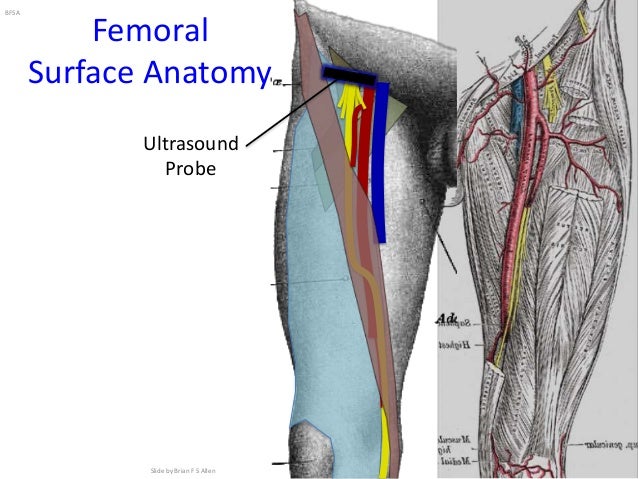 Lower Extremity Regional Anesthesia