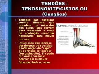 TENDÕES /TENDÕES /
TENOSINOVITE/CISTOS OUTENOSINOVITE/CISTOS OU
(Ganglios)(Ganglios)
• Tendões são espessas
cordas fibrosas que
prendem os músculos
aos ossos. Eles servem
para transmitir a força
de contração muscular
necessária para mover
um osso
• inflamação dos tendões
geralmente traz consigo
a inflamação da "capa"
que protege os tendões
(tenossinovite). Ela pode
ter várias causas e
ocorrer em qualquer
faixa de idade ou sexo.
 
