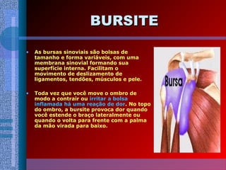 BURSITEBURSITE
• As bursas sinoviais são bolsas de
tamanho e forma variáveis, com uma
membrana sinovial formando sua
superfície interna. Facilitam o
movimento de deslizamento de
ligamentos, tendões, músculos e pele.
• Toda vez que você move o ombro de
modo a contrair ou irritar a bolsa
inflamada há uma reação de dor. No topo
do ombro, a bursite provoca dor quando
você estende o braço lateralmente ou
quando o volta para frente com a palma
da mão virada para baixo.
 