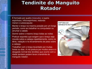 Tendinite do ManguitoTendinite do Manguito
RotadorRotador
• É formado por quatro músculos: o supra-
espinhoso, infra-espinhoso, redondo
menor e subescapular.
• Manter o braço na mesma posição por um longo
período, como ao trabalhar no computador ou
arrumar o cabelo
• Dormir sobre o mesmo braço todas as noites
• Praticar esportes que exigem que o braço seja
movido sobre a cabeça repetidamente, como no
tênis, natação e no levantamento de peso sobre
a cabeça.
• Trabalhar com o braço levantado por muitas
horas ou dias. A má postura por muitos anos e o
desgaste normal dos tendões que ocorre com a
idade também podem levar à tendinite do
manguito rotador.
 