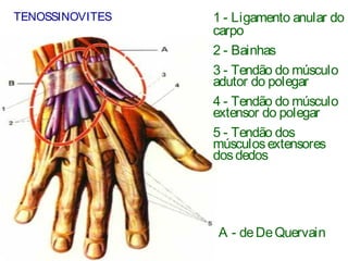TENOSSINOVITES
A - deDeQuervain
1 - Ligamento anular do
carpo
2 - Bainhas
3 - Tendão do músculo
adutor do polegar
4 - Tendão do músculo
extensor do polegar
5 - Tendão dos
músculosextensores
dosdedos
 