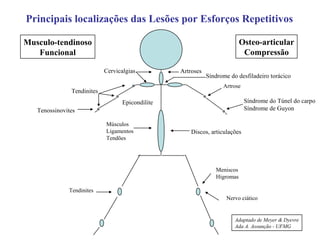 Musculo-tendinoso
Funcional
Osteo-articular
Compressão
Cervicalgias Artroses
Tendinites
Síndrome do desfiladeiro torácico
Artrose
Síndrome do Túnel do carpo
Síndrome de Guyon
Músculos
Ligamentos
Tendões
Tendinites
Discos, articulações
Nervo ciático
Meniscos
Higromas
Principais localizações das Lesões por Esforços Repetitivos
Adaptado de Meyer & Dyevre
Ada A. Assunção - UFMG
Tenossinovites
Epicondilite
 