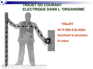 TRAJET
de la tête à la main,
touchant le poumon,
le cœur
TRAJET DU COURANT
ELECTRIQUE DANS L ’ORGANISME
 