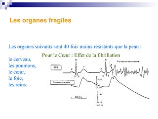 Les organes fragiles
Les organes suivants sont 40 fois moins résistants que la peau :
le cerveau,
les poumons,
le cœur,
le foie,
les reins.
Pour le Cœur : Effet de la fibrillation
 