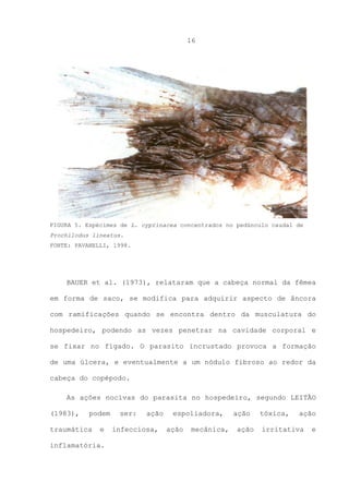 16

FIGURA 5. Espécimes de L. cyprinacea concentrados no pedúnculo caudal de
Prochilodus lineatus.
FONTE: PAVANELLI, 1998.

BAUER et al. (1973), relataram que a cabeça normal da fêmea
em forma de saco, se modifica para adquirir aspecto de âncora
com ramificações quando se encontra dentro da musculatura do
hospedeiro, podendo as vezes penetrar na cavidade corporal e
se fixar no fígado. O parasito incrustado provoca a formação
de uma úlcera, e eventualmente a um nódulo fibroso ao redor da
cabeça do copépodo.
As ações nocivas do parasita no hospedeiro, segundo LEITÃO
(1983),

podem

traumática

e

inflamatória.

ser:

ação

infecciosa,

espoliadora,
ação

mecânica,

ação
ação

tóxica,

ação

irritativa

e

 