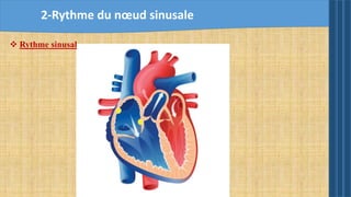  Rythme sinusal
2-Rythme du nœud sinusale
 