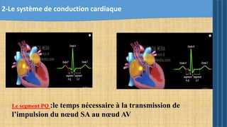 Le segment PQ :le temps nécessaire à la transmission de
l’impulsion du nœud SA au nœud AV
2-Le système de conduction cardiaque
 