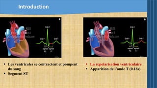 Introduction
 Les ventricules se contractent et pompent
du sang
 Segment ST
 La repolarisation ventriculaire
 Apparition de l’onde T (0.16s)
 
