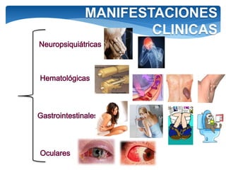 MANIFESTACIONES
CLINICAS
 