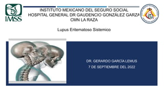 DR. GERARDO GARCÍA LEMUS
7 DE SEPTIEMBRE DEL 2022
INSTITUTO MEXICANO DEL SEGURO SOCIAL
HOSPITAL GENERAL DR GAUDENCIO GONZÁLEZ GARZA
CMN LA RAZA
Lupus Eritematoso Sistemico
 