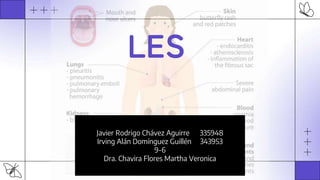 LES
Javier Rodrigo Chávez Aguirre 335948
Irving Alán Domínguez Guillén 343953
9-6
Dra. Chavira Flores Martha Veronica
 