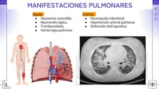 lupus eritematoso sistemico agudo y sus manifestaciones clinicas | PPTX