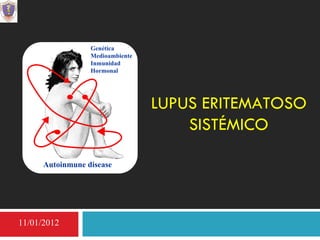 LUPUS ERITEMATOSO SISTÉMICO Autoinmune disease Genética Medioambiente Inmunidad Hormonal 11/01/2012 