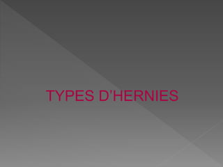 TYPES D’HERNIES
 