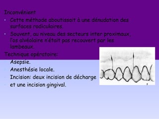 Inconvénient
• Cette méthode aboutissait à une dénudation des
surfaces radiculaires.
• Souvent, au niveau des secteurs inter proximaux,
l’os alvéolaire n’était pas recouvert par les
lambeaux.
Technique opératoire:
• Asepsie.
• Anesthésie locale.
• Incision: deux incision de décharge
• et une incision gingival.
 