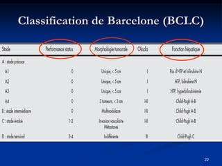 Classification de Barcelone (BCLC)




                                     22
 