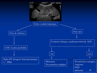 Echo: nodule hépatique


                                                                  Foie sain
      Foie de cirrhose


                                             Contexte clinique: syndrome tumoral, AEG

  CHC: le plus probable

                                            oui                                 non

Alpha FP; Imagerie hémodynamique
+/- PBH                                 Métastase                  Tm primitive bénigne:
                                        Tm primitive maligne       Angiome
                                                                   HNF
                                                                   adénome        45
 