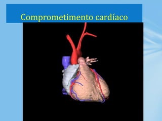 Comprometimento cardíaco
 