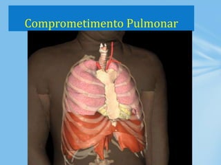 Comprometimento Pulmonar
 