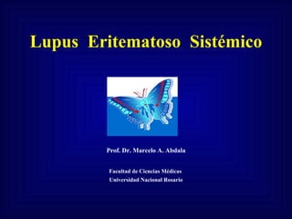 Lupus  Eritematoso  Sistémico Prof. Dr. Marcelo A. Abdala Facultad de Ciencias Médicas  Universidad Nacional Rosario 