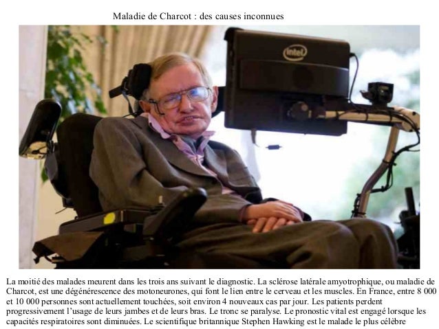 les 30maladies rares les plus etranges
