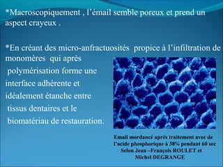 *Macroscopiquement , l’émail semble poreux et prend un
aspect crayeux .
*En créant des micro-anfractuosités propice à l’infiltration de
monomères qui après
polymérisation forme une
interface adhérente et
idéalement étanche entre
tissus dentaires et le
biomatériau de restauration.
Email mordancé après traitement avec de
l’acide phosphorique à 38℅ pendant 60 sec
Selon Jean –François ROULET et
Michel DEGRANGE
 