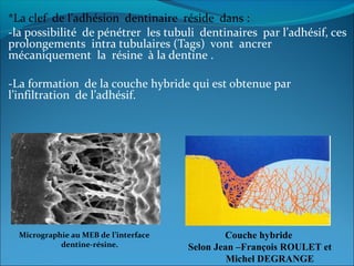 *La clef de l’adhésion dentinaire réside dans :
-la possibilité de pénétrer les tubuli dentinaires par l’adhésif, ces
prolongements intra tubulaires (Tags) vont ancrer
mécaniquement la résine à la dentine .
-La formation de la couche hybride qui est obtenue par
l’infiltration de l’adhésif.
Micrographie au MEB de l’interface
dentine-résine.
Couche hybride
Selon Jean –François ROULET et
Michel DEGRANGE
 