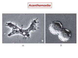 Acanthamoeba
 