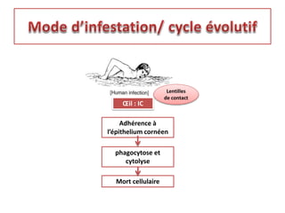Œil : IC
Lentilles
de contact
Adhérence à
l’épithelium cornéen
phagocytose et
cytolyse
Mort cellulaire
 