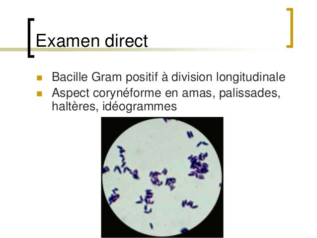 Les anginesbactériennes Les anginesbactériennes