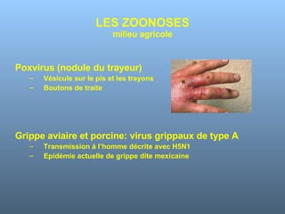 LES ZOONOSES milieu agricole Poxvirus (nodule du trayeur) Vésicule sur le pis et les trayons Boutons de traite Grippe aviaire et porcine: virus grippaux de type A Transmission à l’homme décrite avec H5N1 Epidémie actuelle de grippe dite mexicaine 