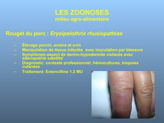 LES ZOONOSES milieu agro-alimentaire Rouget du porc :  Erysipelothrix rhusiopathiae Élevage porcin, aviaire et ovin Manipulation de tissus infectés  avec inoculation par blessure Symptômes:aspect de dermo-hypodermite violacée avec adénopathie satellite’ Diagnostic: contexte professionnel, hémocultures, biopsies cutanées Traitement: Extencilline 1.2 MU 