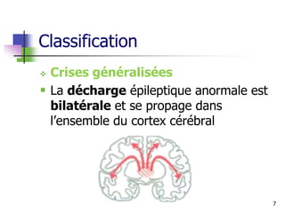 Classification
 Crises généralisées
 La décharge épileptique anormale est
bilatérale et se propage dans
l’ensemble du cortex cérébral
7
 