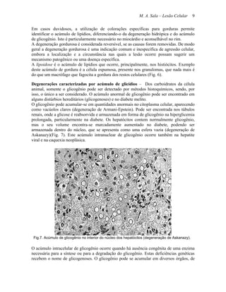 M. A. Sala – Lesão Celular        9

Em casos duvidosos, a utilização de colorações específicas para gorduras permite
identificar o acúmulo de lipídios, diferenciando-o da degeneração hidrópica e do acúmulo
de glicogênio. Isto é particularmente necessário no miocárdio e aconselhável no rim.
A degeneração gordurosa é considerada reversível, se as causas forem removidas. De modo
geral a degeneração gordurosa é uma indicação comum e inespecífica de agressão celular,
embora a localização e a circunstância nas quais a lesão ocorre possam sugerir um
mecanismo patogênico ou uma doença específica.
A lipoidose é o acúmulo de lipídios que ocorre, principalmente, nos histiócitos. Exemplo
deste acúmulo de gordura é a célula espumosa, presente nos granulomas, que nada mais é
do que um macrófago que fagocita a gordura dos restos celulares (Fig. 6).

Degenerações caracterizadas por acúmulo de glicídios – Dos carboidratos da célula
animal, somente o glicogênio pode ser detectado por métodos histoquímicos, sendo, por
isso, o único a ser considerado. O acúmulo anormal de glicogênio pode ser encontrado em
alguns distúrbios hereditários (glicogenoses) e no diabete melito.
O glicogênio pode acumular-se em quantidades anormais no citoplasma celular, aparecendo
como vacúolos claros (degeneração de Armani-Epstein). Pode ser encontrada nos túbulos
renais, onde a glicose é reabsorvida e armazenada em forma de glicogênio na hiperglicemia
prolongada, particularmente na diabete. Os hepatócitos contem normalmente glicogênio,
mas o seu volume encontra-se marcadamente aumentado no diabete, podendo ser
armazenada dentro do núcleo, que se apresenta como uma esfera vazia (degeneração de
Askanazy)(Fig. 7). Este acúmulo intranuclear de glicogênio ocorre também na hepatite
viral e na caquexia neoplásica.




 Fig.7. Acúmulo de glicogênio no interior do núcleo dos hepatócitos (degeneração de Askanazy).

O acúmulo intracelular de glicogênio ocorre quando há ausência congênita de uma enzima
necessária para a síntese ou para a degradação do glicogênio. Estas deficiências genéticas
recebem o nome de glicogenoses. O glicogênio pode se acumular em diversos órgãos, de
 