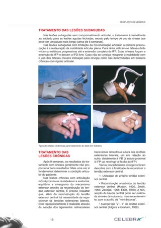 TRATAMENTO DAS LESÕES SUBAGUDAS
Nas lesões subagudas sem comprometimento articular, o tratamento é semelhante
ao adotado para as lesões agudas fechadas, exceto pelo tempo de uso da órtese que
deve ser um pouco mais longo (cerca de 8 semanas).
Nas lesões subagudas com limitação da movimentação articular, a primeira preocu-
pação é a restauração da mobilidade articular plena. Para tanto, utilizam-se órteses dinâ-
micas ou estáticas progressivas até a extensão completa da IFP. Estas órteses forçam a
extensão da IFP e deixam a IFD livre. Caso não se consiga recuperar a mobilidade com
o uso das órteses, haverá indicação para cirurgia como nas deformidades em botoeira
crônicas com rigidez articular.
16
REIMPLANTE DE MEMBROS
Tipos de órteses dinâmicas para tratamento do dedo em botoeira.
TRATAMENTO DAS
LESÕES CRÔNICAS
Após 8 semanas, os resultados do tra-
tamento com órteses geralmente não pro-
porciona bons resultados. Mais uma vez é
fundamental determinar a condição articu-
lar do paciente.
Nas lesões crônicas com articulação
móvel procura-se restabelecer a anatomia,
equilíbrio e sinergismo do mecanismo
extensor através da reconstrução do ten-
dão extensor central. É preciso ressaltar
que, além da reconstrução do tendão
extensor central há necessidade de repo-
sicionar os tendões extensores laterais.
Este reposicionamento é realizado através
da secção dos ligamentos retinaculares
transversos retraídos e sutura dos tendões
extensores laterais, um em relação ao
outro, distalmente à IFD (a sutura proximal
à IFP vai restringir a flexão da IFP).
Vários procedimentos cirúrgicos foram
descritos com a finalidade de reconstruir o
tendão extensor central:
1. Utilização do próprio tendão exten-
sor central
• Reconstrução anatômica do tendão
extensor central (Mason, 1930; Smith,
1966; Zancolli, 1968; Elliot, 1970). A rein-
serção da banda central pode ser realiza-
da através de sutura ou, mais recentemen-
te, com o auxílio de “mini-âncoras”.
• Avanço tipo “V – Y” do tendão exten-
sor central (Kilgore e Graham, 1968).
 
