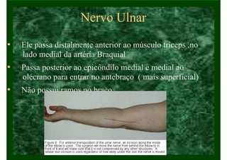 Nervo Ulnar
• Ele passa distalmente anterior ao músculo tríceps ,no
lado medial da artéria Braquial
• Passa posterior ao epicôndilo medial e medial ao
olécrano para entrar no antebraço ( mais superficial)
• Não possui ramos no braço
 