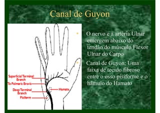 Canal de Guyon
• O nervo e a artéria Ulnar
emergem abaixo do
tendão do músculo Flexor
Ulnar do Carpo
• Canal de Guyon: Uma
faixa de tecido fibroso
entre o osso pisiforme e o
hâmulo do Hamato
 
