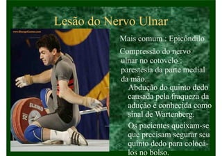 Lesão do Nervo Ulnar
• Mais comum : Epicôndilo
• Compressão do nervo
ulnar no cotovelo :
parestesia da parte medial
da mão.
– Abdução do quinto dedo
causada pela fraqueza da
adução é conhecida como
sinal de Wartenberg.
– Os pacientes queixam-se
que precisam segurar seu
quinto dedo para colocá-
los no bolso.
 